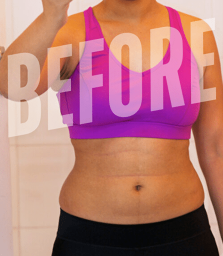 Before Image Before Image